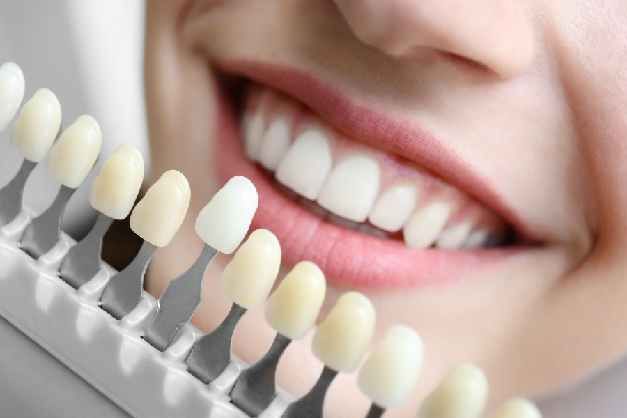 Four Benefits of Investing in Cosmetic Dentistry