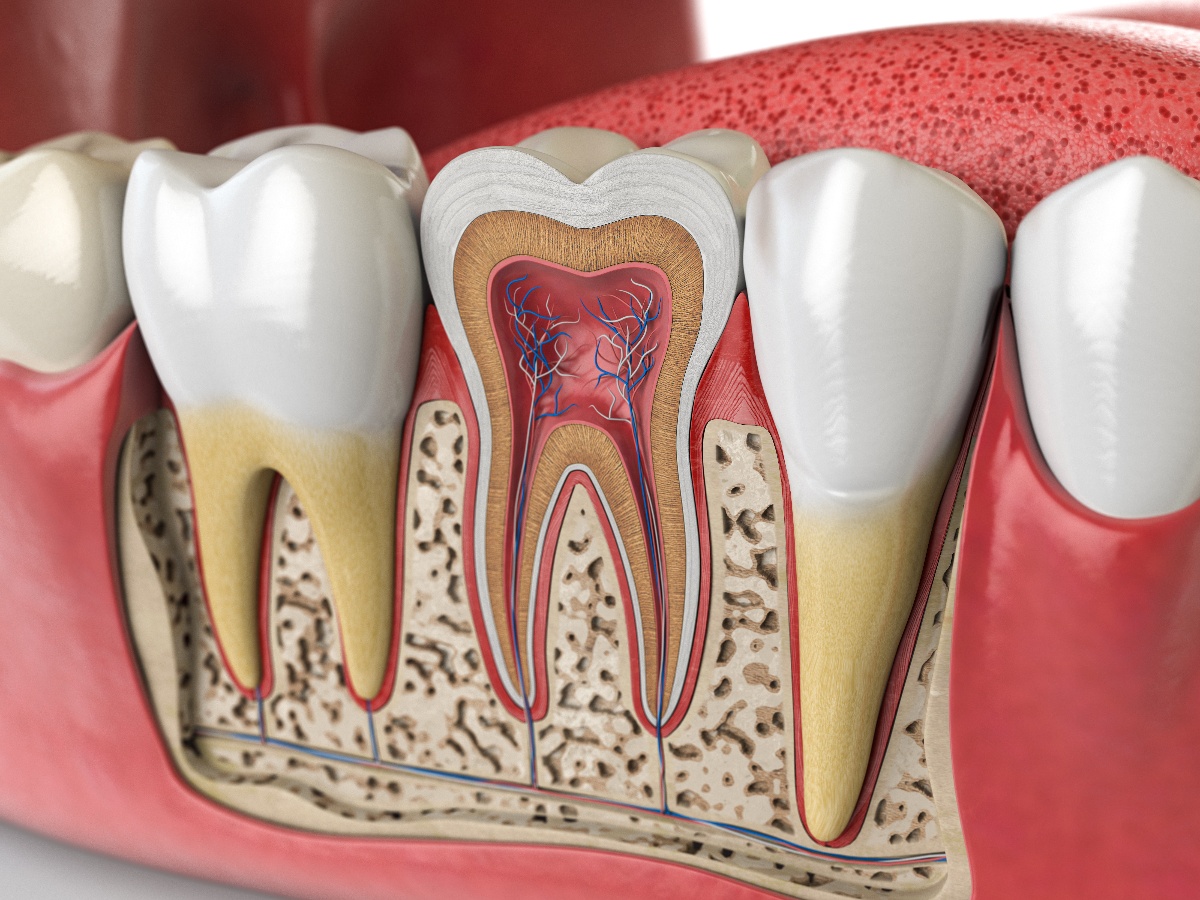 Signs You May Need a Root Canal: Understanding the Symptoms