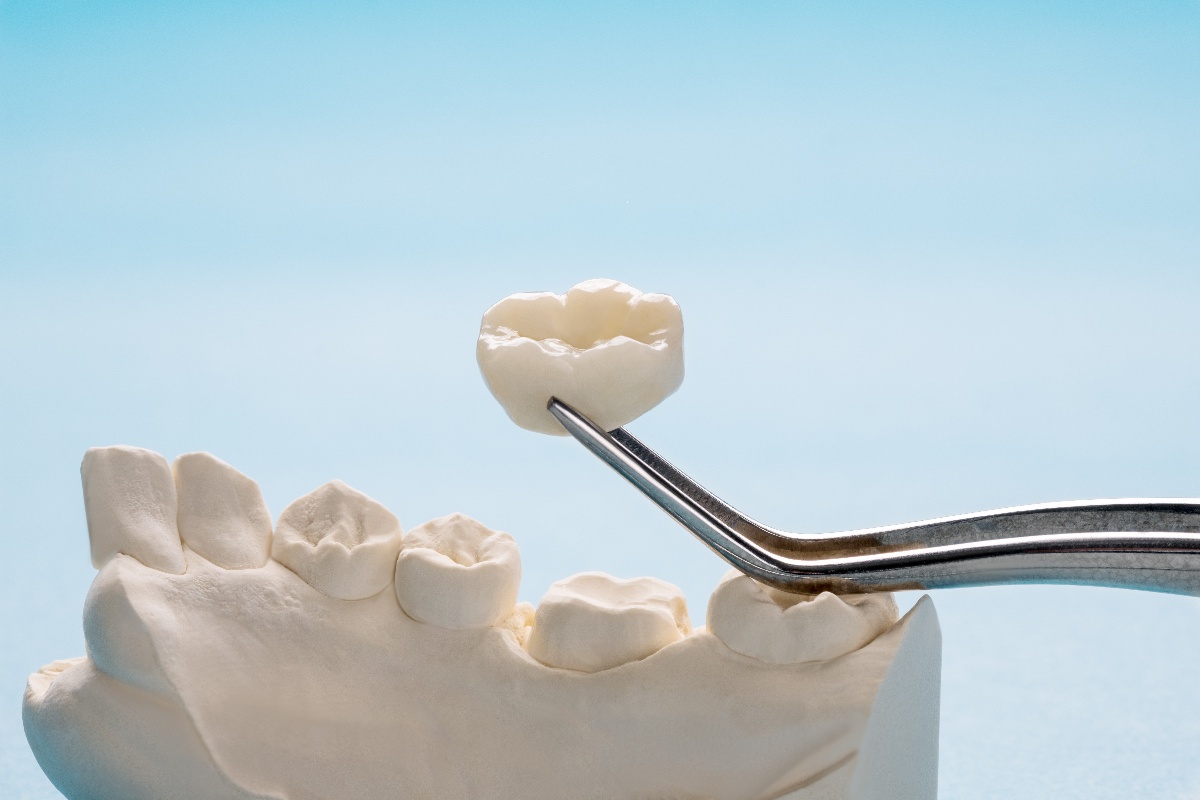 How Zirconia Crowns Can Improve Your Smile and Oral Health
