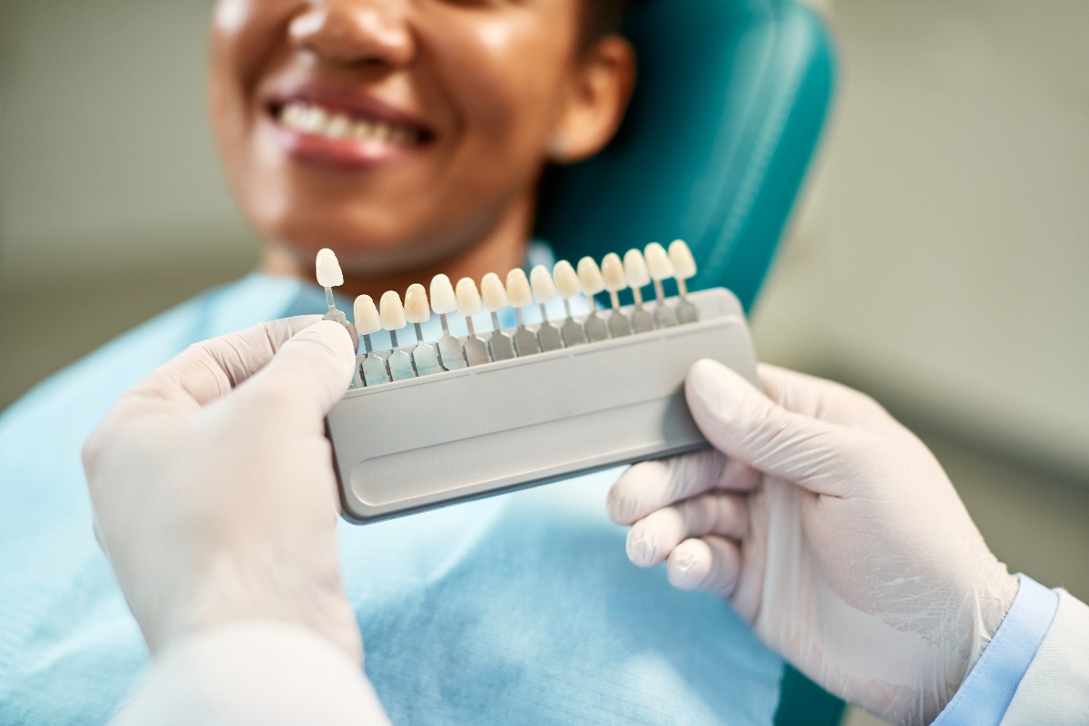 Myths and Facts: Clearing Up Common Misconceptions About Dental Veneers
