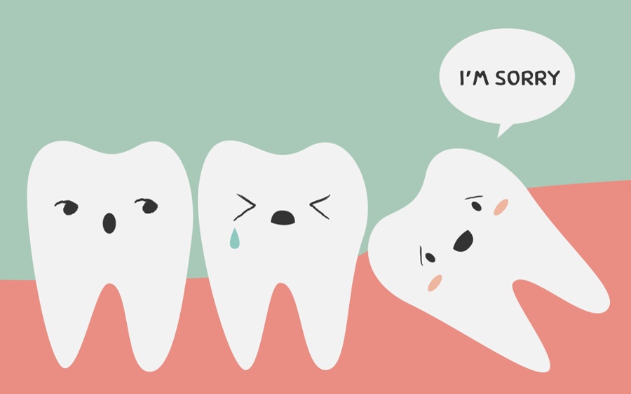 wisdom tooth extraction surgery